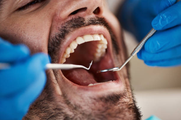 Best Emergency Treatment for Jaw Pain or Injury in Tuskegee, AL